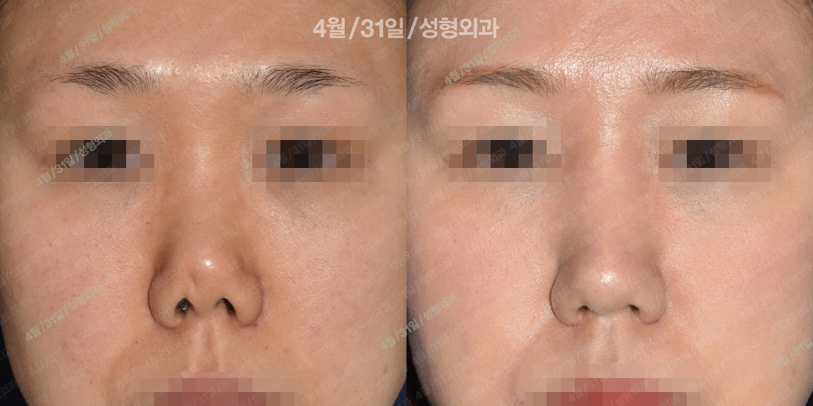 정면