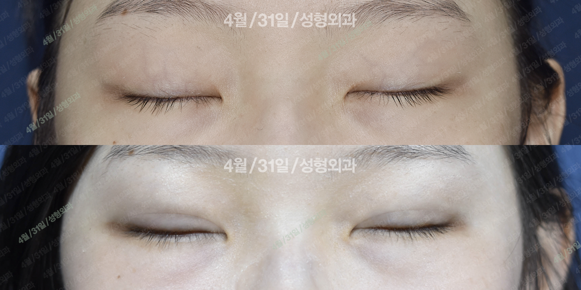 정면