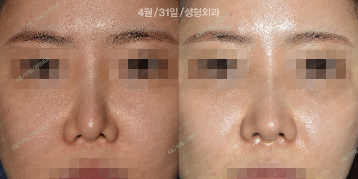 정면