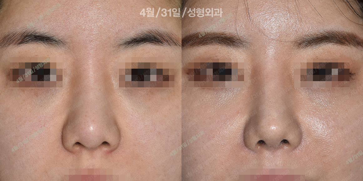정면