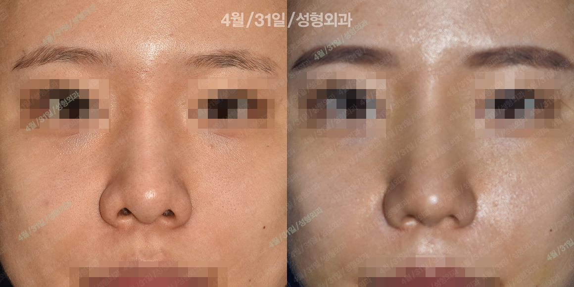 정면