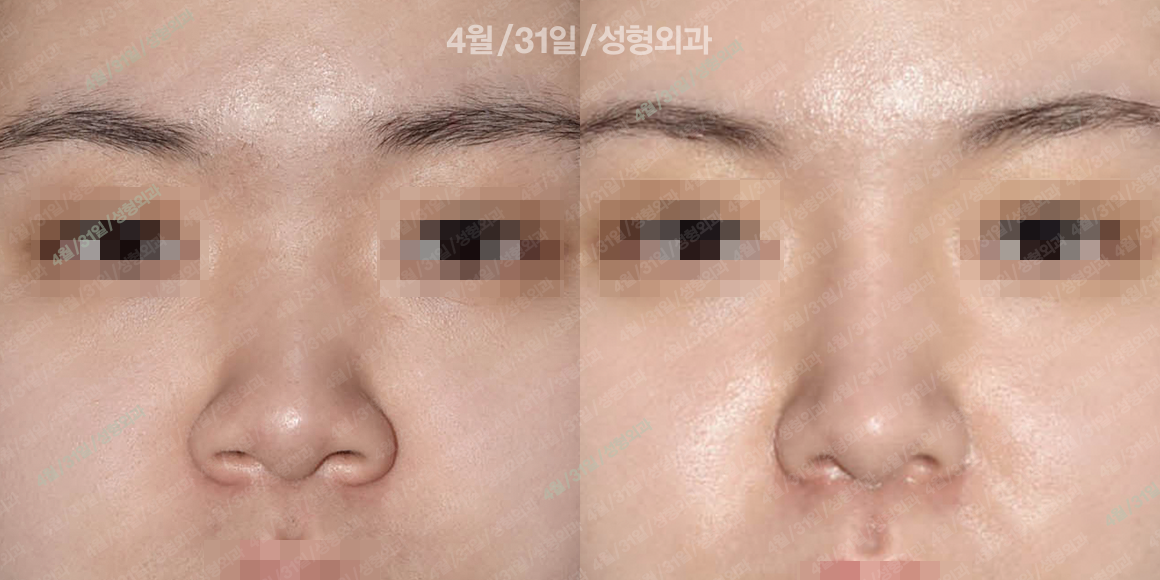 정면