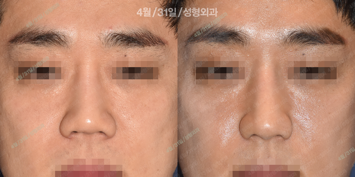 정면