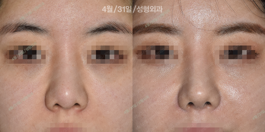 정면